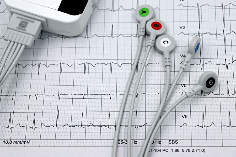 EKG-Aufzeichnung zur Herzuntersuchung (Symbolbild)