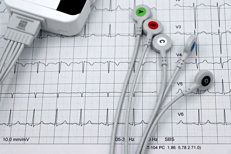 EKG-Aufzeichnung zur Herzuntersuchung (Symbolbild)